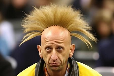 Hair Plugs: Because Who Needs a Natural Hairline Anyway?